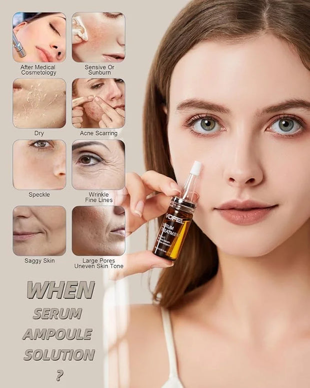 Anti Aging Serum with Hyaluronic Acid Vitamin C Serum for Face Centella Serum Moisturizer 0.35 oz 4 Kits 16 Vials Facial S...