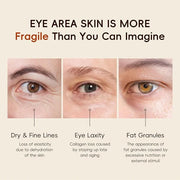 Easilydays Vitamin C Eye Cream & Under Eye Serum, Refreshing, Hydrating, Radiant Glow Eye Care Eye Roller Serum with 360° ...