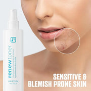 BRIOTECH Renew Toner, Hypochlorous Acid Spray, Minimize Appearance of Blemishes, Soothing Facial Mist for Sensitive Skin, ...