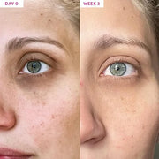 Sand & Sky Australian Essentials Anti-Aging Eye Cream with Peptides & Vitamin C - Under-Eye Brightening Formula, Reduces D...
