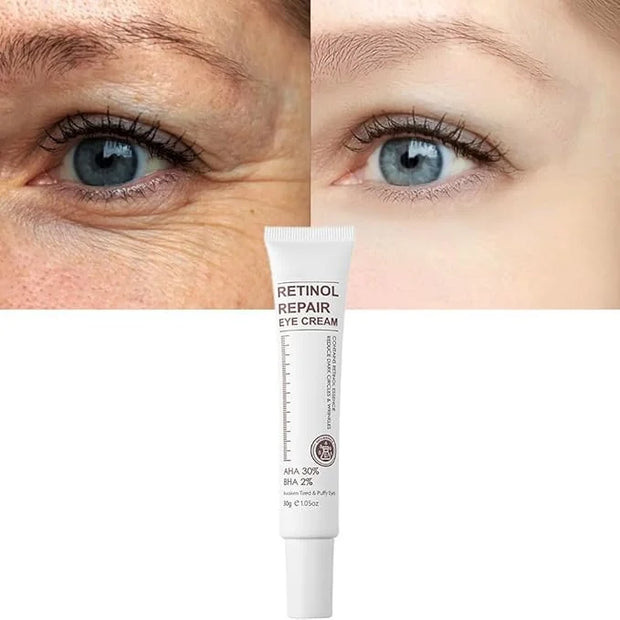Magic Retinol Eye Cream for Dark Circles Puffiness and Bags Under Eyes, Instant Results Firm Eye Tightener Reduce Fine Lin...
