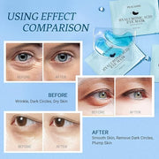 Under Eye Patchs Hyaluronic Acid Eye Mask for Dark Circles and Puffiness Wrinkle Eye Bags 30 Pairs - Product Image