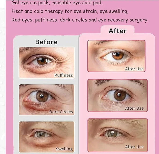 Eye Ice Pack, Gel Eye Ice Pack, Reusable Cold Compress for Migraine, Flexible Cooling Gel Pads for Eyes, Headaches and Pos...
