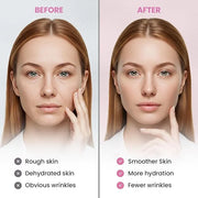 (BUNDLE) Facial and Forehead Wrinkle Patches: Face Wrinkle Treatment for Forehead, Smile Line, Under Eye- Anti Wrinkle Pat...