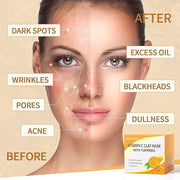 Vitamin C Face Mask with Kaolin Clay and Turmeric for Dark Spots, Dull Skin, Skincare Facial Mask for Controlling Oil and ...