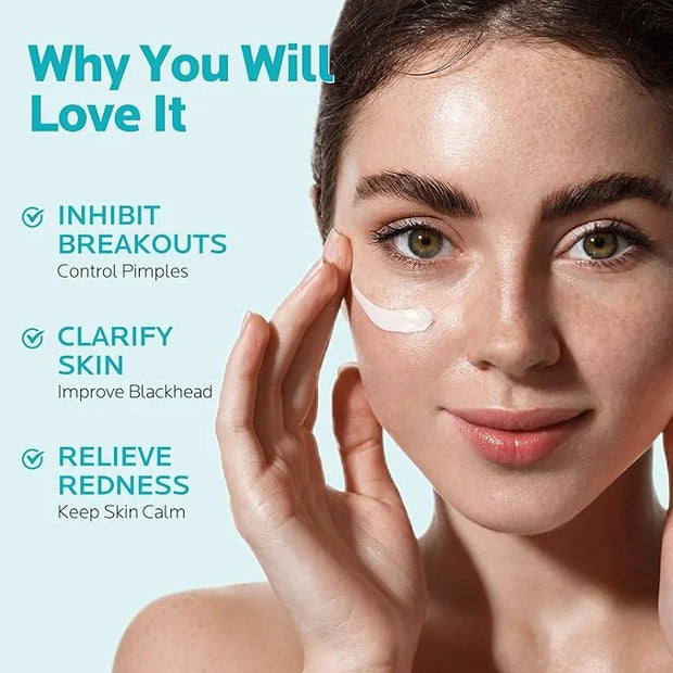 ZealSea 10% Azelaic Acid Facial Cream - Azelaic Acid Serum with AHA & Pionin for Face, Relief Pimple, Breakouts, Blackhead...