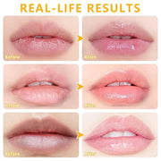 5 PCS Bee Balm Lip Balm