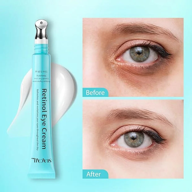Retinol Eye Cream - Eye Serum for Dark Circles & Puffiness Anti-Aging - Under Eye Cream with Hyaluronic Acid & Caffeine to...