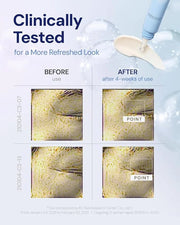 PDRN Eye Cream – Under Eye Cream for Puffiness and Bags, Korean Skin Care with Centella, Panthenol & b-PDRN | Firming & Hy...