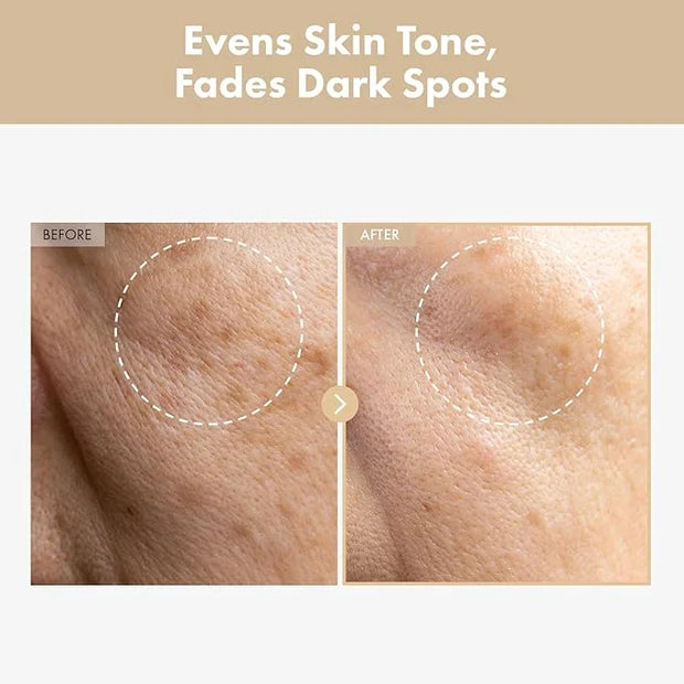 Rice Glow Milky Toner with 784,000ppm Korean Rice Water, Niacinamide, Ceramides, Panthenol, Glow, Glass Skin, Hydrating, P...