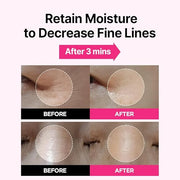ISOI Blemish Care Eye & Wrinkle Patch, Hyaluronic Acid Eye Masks for Hydration & Firming with Bulgarian Rose Oil, Targeted...