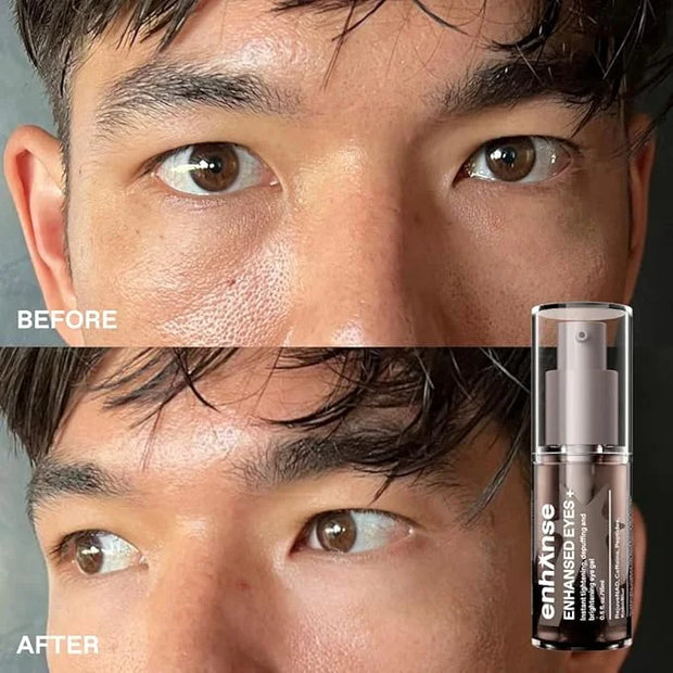 Under Eye Gel for Men, Caffeine Eye Cream, Peptides, RejuveNAD, Instant Tightening, Brightening, Depuffing for Under Eye B...