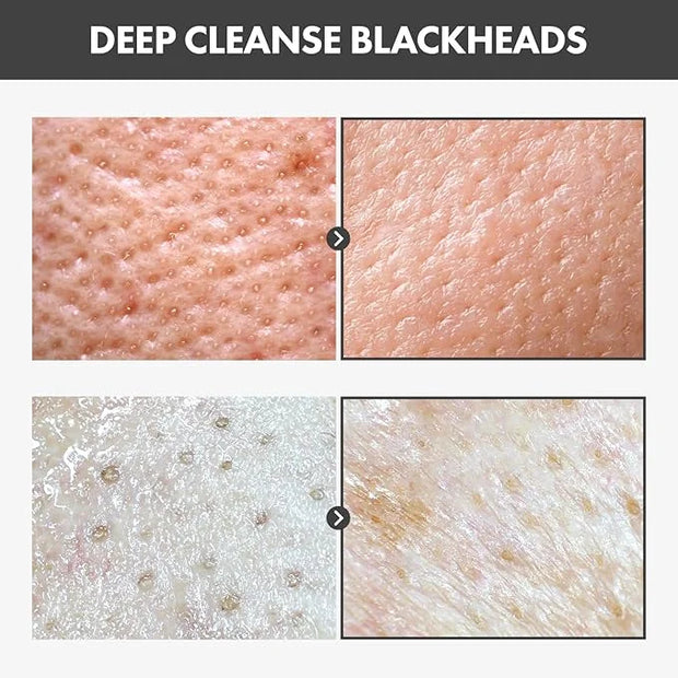 Blackhead Peel Off Pack, Charcoal Face Mask Peel Off for Blackheads and Pores, Deep Pore Cleansing, Pore Extractor Exfolia...