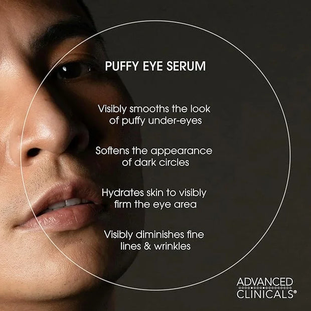 Advanced Clinicals Puffy Eye Under Eye Serum | Visible Anti Aging Brightening Vitamin C + Caffeine Serum Helps Improve Loo...
