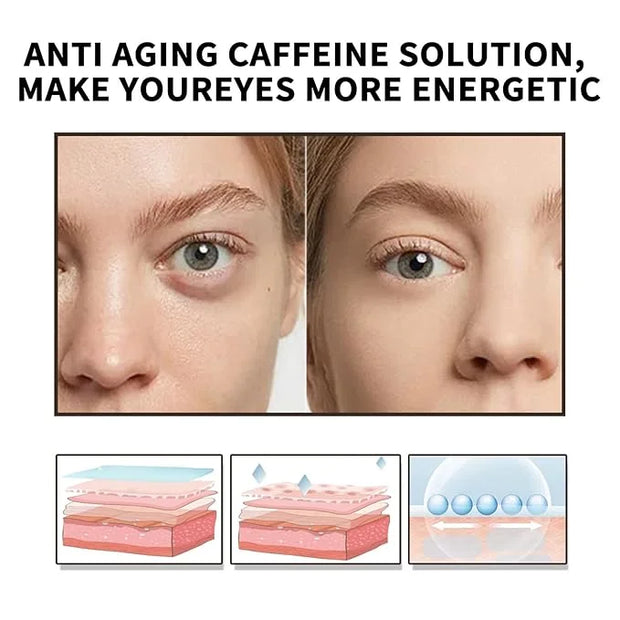 Caffeine Eye Serum With EGCG For Dark Circles and Puffiness, Anti Aging 5% Caffeine Solution For Puffy Eyes, Fine Lines, M...