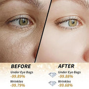 Golden Glow Under Eye Patches for Puffy Eyes - 60Pcs Eye Gels Rejuvenating Treatment for Dark Circles, Puffiness, Refreshi...