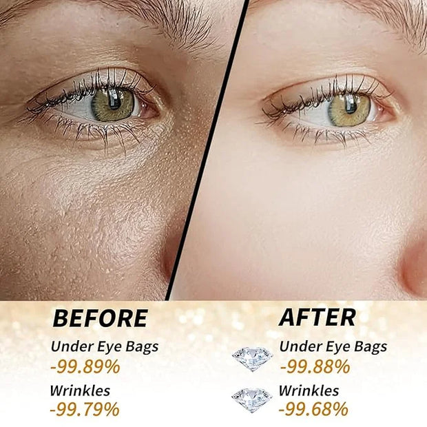 Golden Glow Under Eye Patches for Puffy Eyes - 60Pcs Eye Gels Rejuvenating Treatment for Dark Circles, Puffiness, Refreshi...