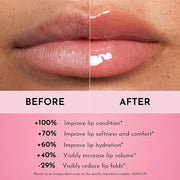 Forget the Filler Lip Plumping Line Smoothing Gloss - Cherry Vanilla - Premium Volumizing Lip Gloss with Natural Ingredien...