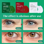 Under Eye Patches For Puffy Eyes and Dark Circles Wrinkle,30 Pairs Face Masks SkinCare With Retinol Serum,Aloe Vera,Rose B...