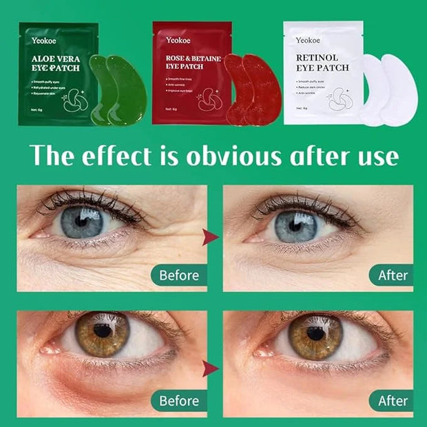 Under Eye Patches For Puffy Eyes and Dark Circles Wrinkle,30 Pairs Face Masks SkinCare With Retinol Serum,Aloe Vera,Rose B...