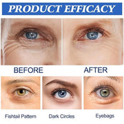12 Picecs Malora Microglow Eye Patches,Hyaluronic Patchess for Under,Malora Under EyePatches for Wrinkles,Reduces Puffines...