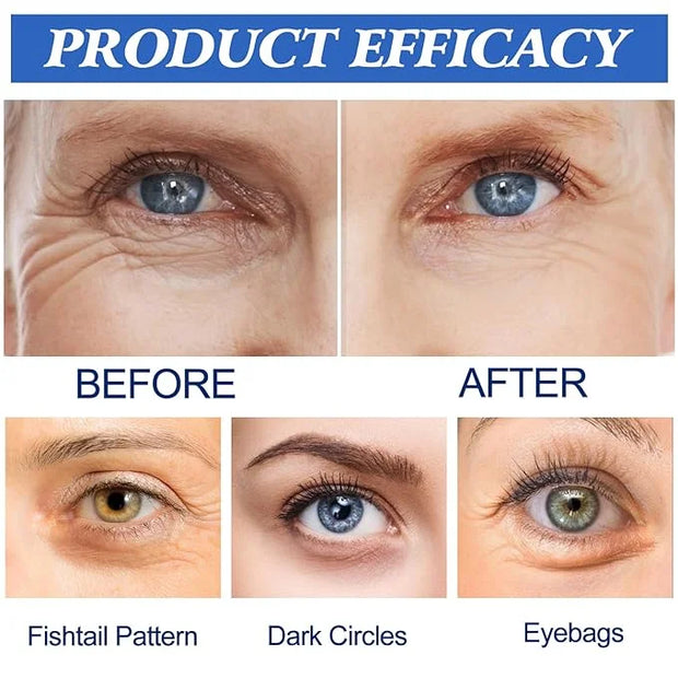 12 Picecs Malora Microglow Eye Patches,Hyaluronic Patchess for Under,Malora Under EyePatches for Wrinkles,Reduces Puffines...