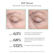 BIOEFFECT EGF Serum, Eye Serum, Eye Mask Skincare Set: Firming Favorites, with Barley Growth Factor - Product Image