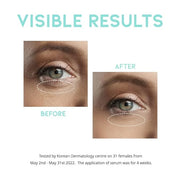 Retinol Eye Cream Serum For Wrinkle Lift, Anti Aging, Under Eye Bag, Puffy Eyes and Dark Circles Treatment, Ceramide, Hyal...