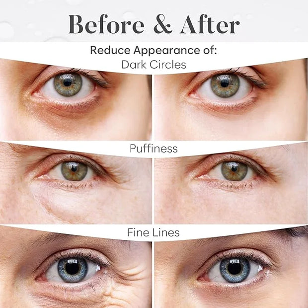 Variety Under Eye Patches (30 Pairs) Under Eye Patches for Dark Circles, Under Eye Patches for Puffy Eyes and Dark Circles...
