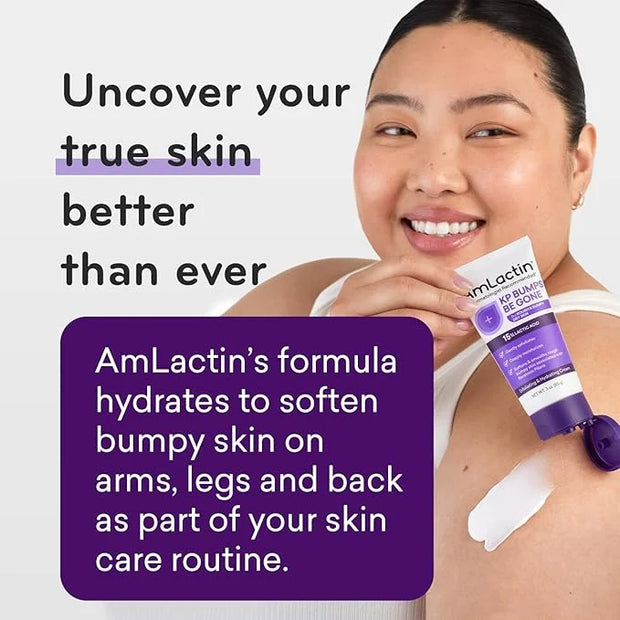 AmLactin KP Bumps Be Gone - 3 oz Keratosis Pilaris Moisturizing Cream with 15% Lactic Acid - Exfoliator and Moisturizer fo...