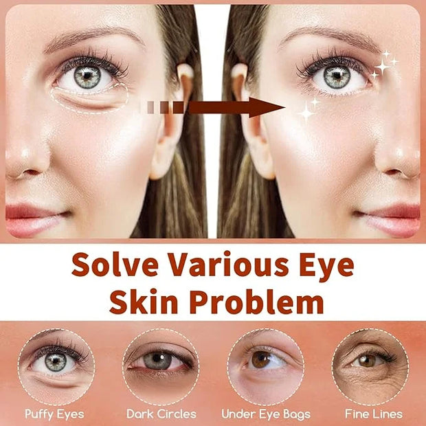 Caffeine Under Eye Masks, 60 Pcs Brightening Eye Patches for Dark Circles and Puffiness with Hyaluronic Acid, Reduce Dark ...