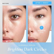 belif Aqua Bomb Cooling Eye Gel - Caffeine & Hyaluronic Acid for Puffiness & Hydration, Niacinamide & Vitamin C for Dark C...