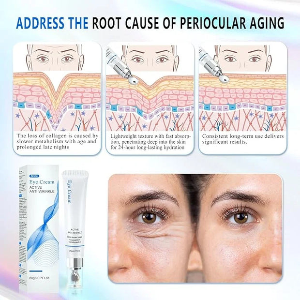 Eye Repair Cream - And Bags Under Eyes,Anti-Aging,Anti-Oxidant,Lightens Fine Lines,Reduces Wrinkles,For Women Under Eye Cr...