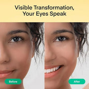 Vitamin C Niacinamide Eye Patches: Brightening & Glowing Under Eye Mask with Tranexamic Acid Caffeine Hyaluronic Acid - Ko...
