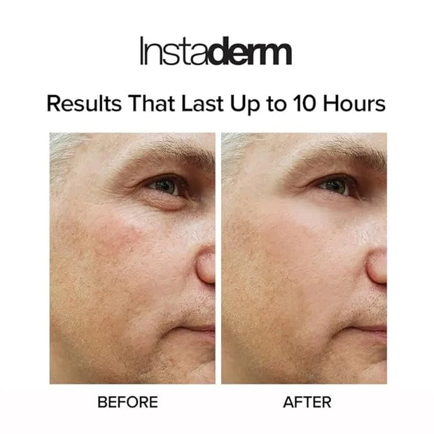 Instant Puffy Eye & Lift Treatment – Removes Under Eye Bags & Puffiness. Eliminate Dark Circles & Wrinkles. Naturally Agel...