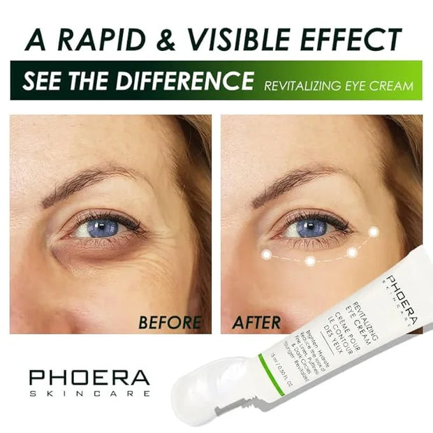 Phoera Revitalizing Eye Cream Brighten Hydrate Reduce The Fine Lines, Dark Circle Wrinkles And Puffiness For Men And Women...