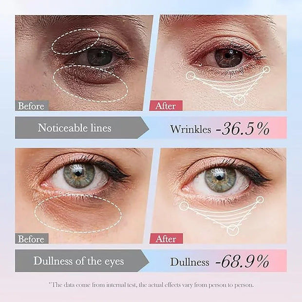 Eye Cream with 30% Retinol, 10% Hyaluronic Acid, 5% Nicotinamide, 10% Vitamin C for Puffy Bags Fine Lines Dark Circles Wri...