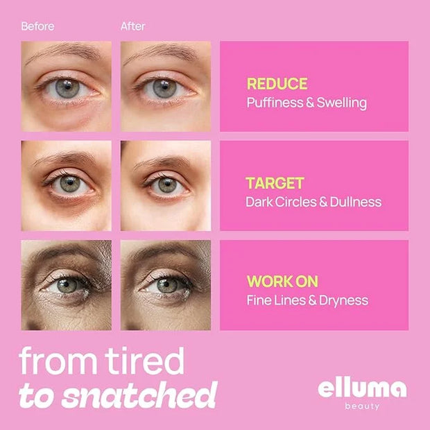 Under Eye Patches 12 Pairs of Themed Hydrogel Eye Gel Pads - For Puffy Eyes and Dark Circles, Under Eye Bags, Wrinkles - H...