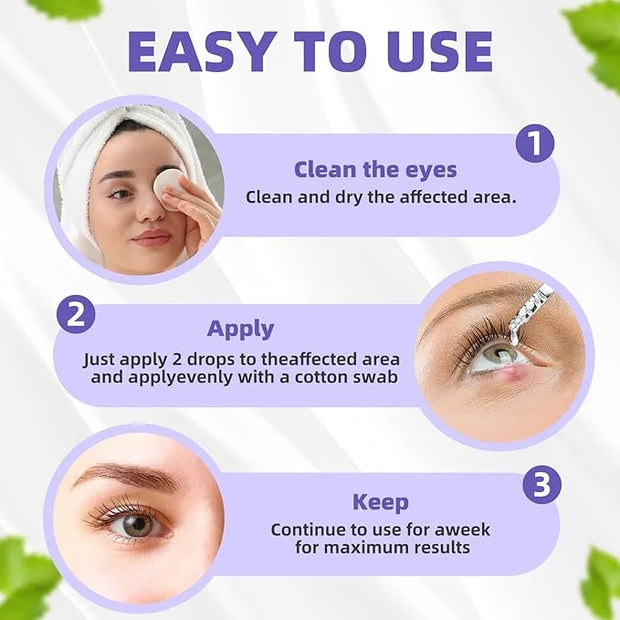 Stye Eye Treatment, Natural Relief Drops Serum for Styes Chalazion and Blepharitis, Fast Chalazion Remover for Restore Hea...