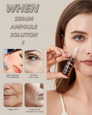 Anti Aging Serum with Hyaluronic Acid for Microneedling Serum BB Glow Starter Kit Serum Ampoules for Face 0.35 oz 4 Vials ...