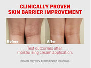 ATOPALM | Intensive Moisturizing Cream | Face & Body Moisturizer | For Dry & Sensitive Skin | Paraben-Free Lotion | Replen...