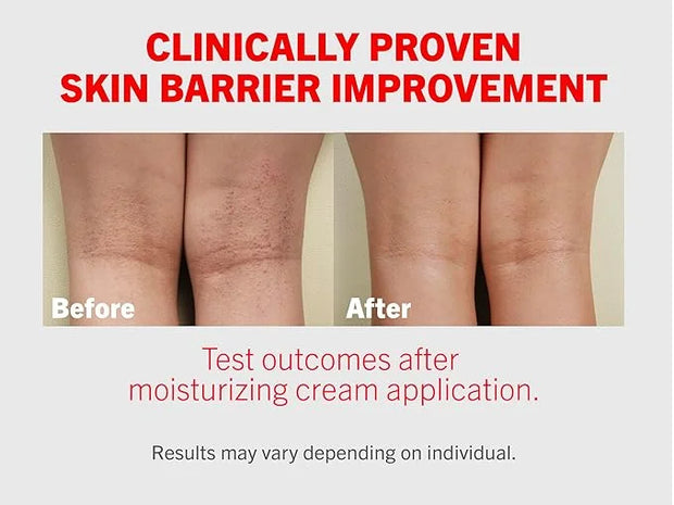ATOPALM | Intensive Moisturizing Cream | Face & Body Moisturizer | For Dry & Sensitive Skin | Paraben-Free Lotion | Replen...