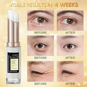 COSMOO Snail Peptide Advanced Under Eye Cream for Dark Circles, With Snail Mucin, Advanced Snail Eye Stick For Puffiness &...
