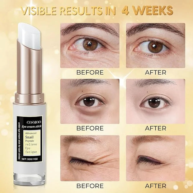 COSMOO Snail Peptide Advanced Under Eye Cream for Dark Circles, With Snail Mucin, Advanced Snail Eye Stick For Puffiness &...