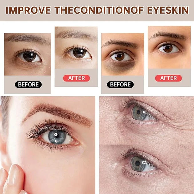 The Caffeine Solution 5% + EGCG，Reduces Appearance of Eye Contour Pigmentation and Puffiness，Under Eye Serum (30ml) Caffei...