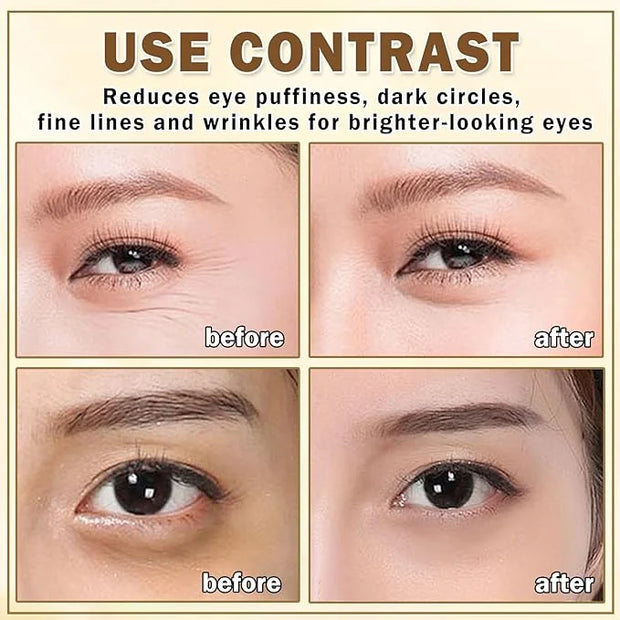 Eye Cream for Dark Circles Puffiness and Bags Eye Serum Eye Roller for Puffy Eyes Under Eye Cream for for Women Daily Skin...