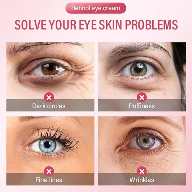 Retinol Eye Cream for Dark Cir-cles - Eye Cream Anti Aging - Hydrating eye Care Products - Eye Serum - Anti-Wrinkle Eye cr...