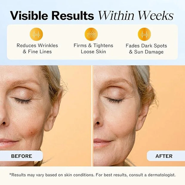 LilyAna Naturals Anti Aging Retinol Face Cream for Women – Wrinkle & Neck Cream for Firming, Retinol Moisturizer for Face ...