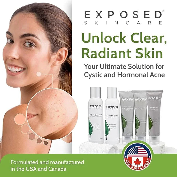 Exposed Skin Care Expanded Acne Treatment Kit - Includes Salicylic Acid Face Wash, Clearing Tonic, Treatment Serum with Be...