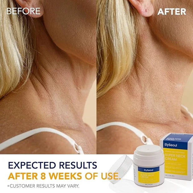 Korean Neck Cream for Firming & Tightening: Neck & Chest Anti-Aging Treatment for Crepey Sagging Skin & Wrinkles - Women &...